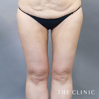 【THE CLINIC 症例画像】No.1608_2