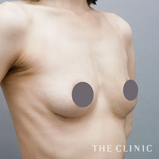 【THE CLINIC 症例画像】No.1610_2