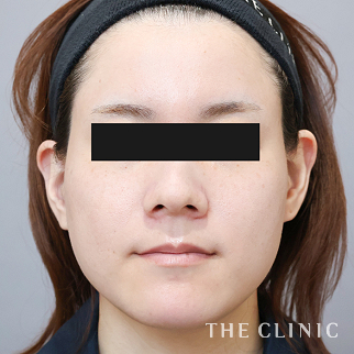 【THE CLINIC 症例画像】No.1620_1