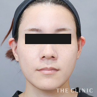 【THE CLINIC 症例画像】No.1620_2