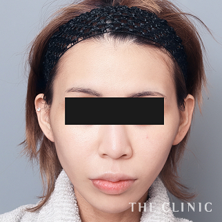 【THE CLINIC 症例画像】No.1634_1