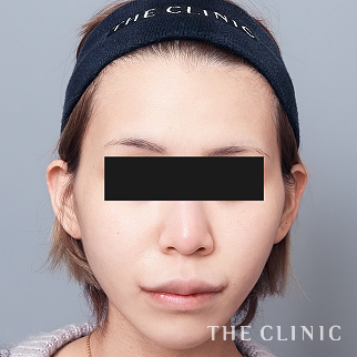 【THE CLINIC 症例画像】No.1634_2