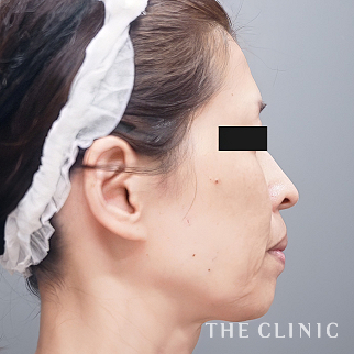 【THE CLINIC 症例画像】No.1638_1