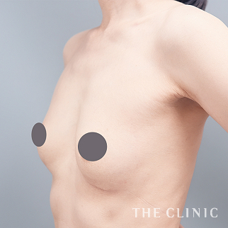 【THE CLINIC 症例画像】No.1646_2