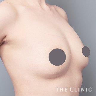 【THE CLINIC 症例画像】No.1654_2