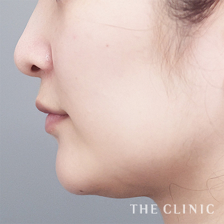 【THE CLINIC 症例画像】No.1656_1