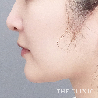 【THE CLINIC 症例画像】No.1656_2