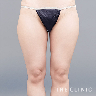 【THE CLINIC 症例画像】No.1657_1