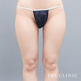 【THE CLINIC 症例画像】No.1657_2