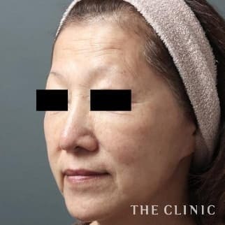 【THE CLINIC 症例画像】No.169_1