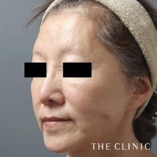 【THE CLINIC 症例画像】No.169_2