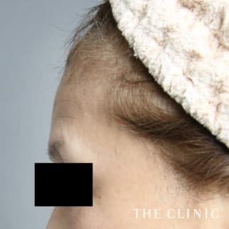 【THE CLINIC 症例画像】No.395_1