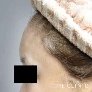 【THE CLINIC 症例画像】No.395_2