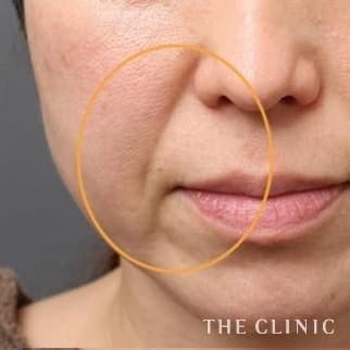 【THE CLINIC 症例画像】No.464_1