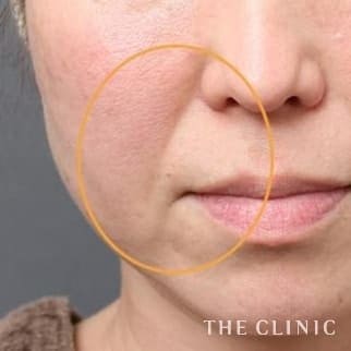 【THE CLINIC 症例画像】No.464_2