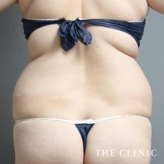 【THE CLINIC 症例画像】No.497_1
