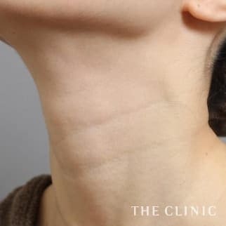 【THE CLINIC 症例画像】No.520_1