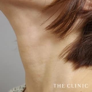 【THE CLINIC 症例画像】No.520_2