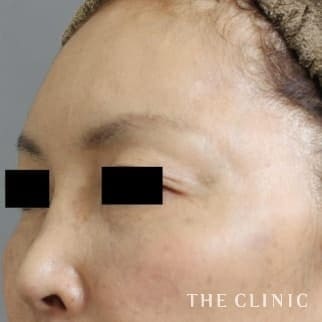 【THE CLINIC 症例画像】No.524_2