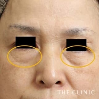 【THE CLINIC 症例画像】No.525_1