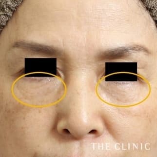 【THE CLINIC 症例画像】No.525_2