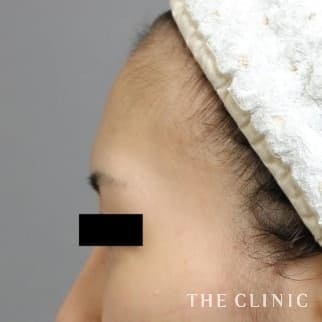 【THE CLINIC 症例画像】No.543_1