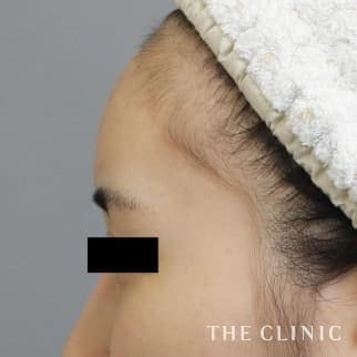 【THE CLINIC 症例画像】No.543_2