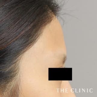 【THE CLINIC 症例画像】No.549_1