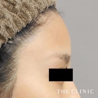 【THE CLINIC 症例画像】No.549_2