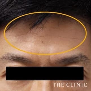 【THE CLINIC 症例画像】No.57_1