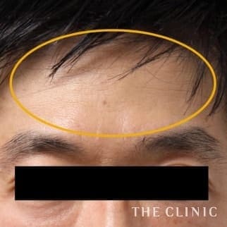 【THE CLINIC 症例画像】No.57_2