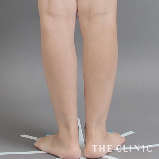 【THE CLINIC 症例画像】No.601_2