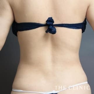 【THE CLINIC 症例画像】No.616_2