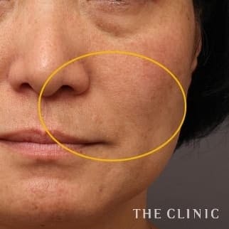 【THE CLINIC 症例画像】No.626_1