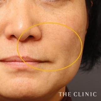 【THE CLINIC 症例画像】No.626_2