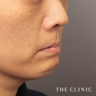 【THE CLINIC 症例画像】No.660_1