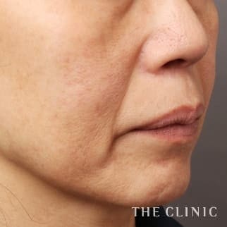 【THE CLINIC 症例画像】No.671_1