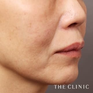 【THE CLINIC 症例画像】No.671_2