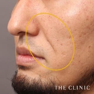 【THE CLINIC 症例画像】No.674_1