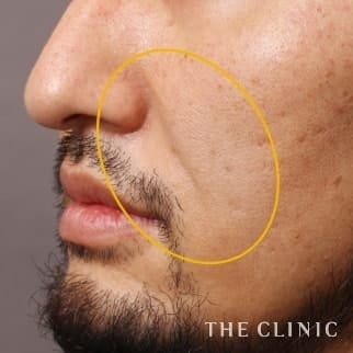 【THE CLINIC 症例画像】No.674_2