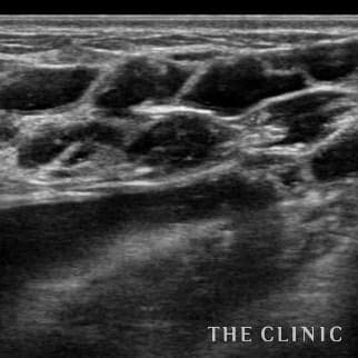 【THE CLINIC 症例画像】No.696_1