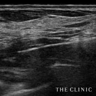 【THE CLINIC 症例画像】No.696_2