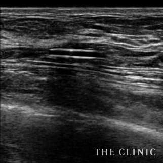 【THE CLINIC 症例画像】No.697_2