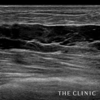 【THE CLINIC 症例画像】No.698_1