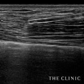 【THE CLINIC 症例画像】No.698_2