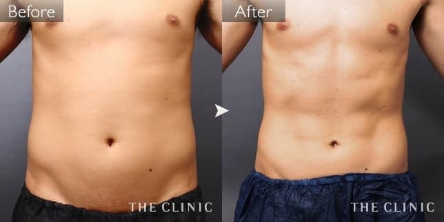 腰・ウエスト（男性／31歳）