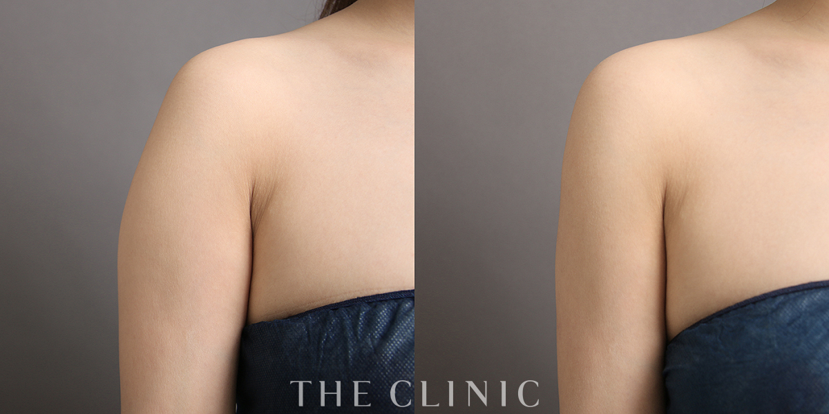 THECLINIC症例写真