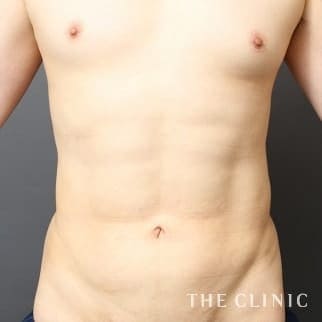 【THE CLINIC 症例画像】No.739_2