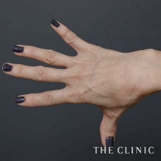 【THE CLINIC 症例画像】No.816_1