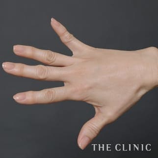 【THE CLINIC 症例画像】No.816_2